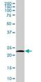 NADH:Ubiquinone Oxidoreductase Core Subunit V2 antibody, H00004729-B01P, Novus Biologicals, Western Blot image 