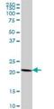 COP9 Signalosome Subunit 8 antibody, H00010920-B02P, Novus Biologicals, Western Blot image 