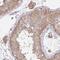 Chromosome 19 Open Reading Frame 54 antibody, NBP2-32418, Novus Biologicals, Immunohistochemistry paraffin image 