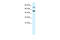 CHM Like Rab Escort Protein antibody, 31-091, ProSci, Western Blot image 