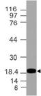 Regenerating islet-derived protein 3-alpha antibody, A05686, Boster Biological Technology, Western Blot image 