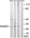 RAB5C, Member RAS Oncogene Family antibody, TA314414, Origene, Western Blot image 