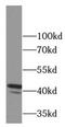 FAS antibody, FNab03017, FineTest, Western Blot image 