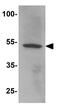 Lysine Acetyltransferase 5 antibody, GTX31538, GeneTex, Western Blot image 
