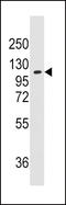 Alanyl-TRNA Synthetase antibody, LS-C100176, Lifespan Biosciences, Western Blot image 