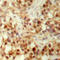 p53 antibody, LS-C368602, Lifespan Biosciences, Immunohistochemistry paraffin image 