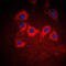 Keratin 10 antibody, GTX56159, GeneTex, Immunofluorescence image 