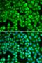 WASP antibody, LS-B14853, Lifespan Biosciences, Immunofluorescence image 