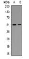 MAP kinase-interacting serine/threonine-protein kinase 1 antibody, orb382452, Biorbyt, Western Blot image 