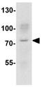 SMAD Specific E3 Ubiquitin Protein Ligase 1 antibody, GTX17223, GeneTex, Western Blot image 