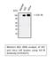 Insulin Like Growth Factor 1 Receptor antibody, STJ93647, St John