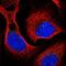 Receptor-associated protein 80 antibody, NBP1-87157, Novus Biologicals, Immunofluorescence image 