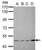 Estrogen Receptor 2 antibody, MA1-23219, Invitrogen Antibodies, Western Blot image 
