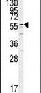 Glutamate Decarboxylase Like 1 antibody, PA5-13434, Invitrogen Antibodies, Western Blot image 