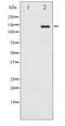 ABL Proto-Oncogene 1, Non-Receptor Tyrosine Kinase antibody, LS-C417348, Lifespan Biosciences, Western Blot image 