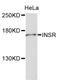 Insulin Receptor antibody, A11847, ABclonal Technology, Western Blot image 