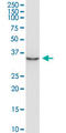 Aminoacyl TRNA Synthetase Complex Interacting Multifunctional Protein 2 antibody, LS-C198514, Lifespan Biosciences, Western Blot image 