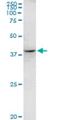 Rhox Homeobox Family Member 2 antibody, H00084528-M07, Novus Biologicals, Western Blot image 