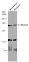 SH3 And Multiple Ankyrin Repeat Domains 3 antibody, GTX133133, GeneTex, Western Blot image 