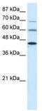 Protein Arginine Methyltransferase 3 antibody, TA329912, Origene, Western Blot image 