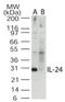 Interleukin 24 antibody, AP07161PU-N, Origene, Western Blot image 