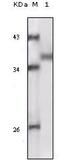 Ribosomal Protein S6 Kinase A1 antibody, MA5-15341, Invitrogen Antibodies, Western Blot image 