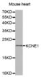 Potassium Voltage-Gated Channel Subfamily E Regulatory Subunit 1 antibody, abx000903, Abbexa, Western Blot image 