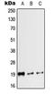 Calc antibody, LS-C353704, Lifespan Biosciences, Western Blot image 