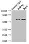 Prolyl 4-Hydroxylase Subunit Alpha 2 antibody, LS-C376255, Lifespan Biosciences, Immunoprecipitation image 