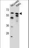 PLAG1 Zinc Finger antibody, LS-C163767, Lifespan Biosciences, Western Blot image 