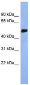 Serine/Threonine Kinase 25 antibody, TA346752, Origene, Western Blot image 