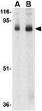 Stromal Interaction Molecule 1 antibody, GTX31757, GeneTex, Western Blot image 