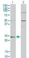 Guanylate Kinase 1 antibody, PA5-23119, Invitrogen Antibodies, Western Blot image 