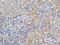 Protein Kinase C Epsilon antibody, GTX55749, GeneTex, Immunohistochemistry paraffin image 