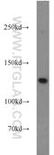 MutS Homolog 3 antibody, 22393-1-AP, Proteintech Group, Western Blot image 