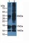 Calcitonin antibody, abx132039, Abbexa, Western Blot image 
