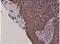 Keratin 5 antibody, NBP2-61524, Novus Biologicals, Immunohistochemistry paraffin image 