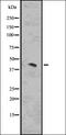 ATPase H+ Transporting Accessory Protein 2 antibody, orb336625, Biorbyt, Western Blot image 