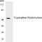 Tryptophan Hydroxylase 1 antibody, EKC1578, Boster Biological Technology, Western Blot image 