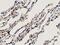 Annexin A3 antibody, M04796-1, Boster Biological Technology, Immunohistochemistry paraffin image 