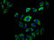 EvC Ciliary Complex Subunit 2 antibody, LS-C680431, Lifespan Biosciences, Immunofluorescence image 