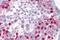 Sp7 Transcription Factor antibody, ARP32231_P050, Aviva Systems Biology, Immunohistochemistry paraffin image 