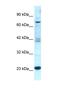 Regulator Of G Protein Signaling 10 antibody, NBP1-55396, Novus Biologicals, Western Blot image 