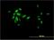 Forkhead Box A2 antibody, H00003170-M01, Novus Biologicals, Immunocytochemistry image 
