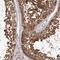 VPS37A Subunit Of ESCRT-I antibody, NBP1-81994, Novus Biologicals, Immunohistochemistry frozen image 