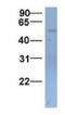 Solute Carrier Family 22 Member 11 antibody, NBP1-69536, Novus Biologicals, Western Blot image 