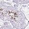 Zinc Finger Protein 568 antibody, PA5-62544, Invitrogen Antibodies, Immunohistochemistry paraffin image 