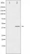 C-C Motif Chemokine Receptor 5 (Gene/Pseudogene) antibody, GTX52329, GeneTex, Western Blot image 