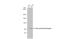 Nuclear Receptor Subfamily 3 Group C Member 1 antibody, GTX113208, GeneTex, Western Blot image 
