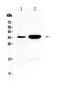 Carbonic Anhydrase 4 antibody, PA5-78900, Invitrogen Antibodies, Western Blot image 